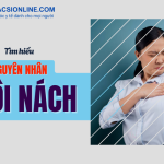 Công nghệ trị hôi nách mới nhất giúp loại bỏ mùi khó chịu hiệu quả