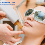 Cách tẩy nốt ruồi nhanh nhất được chuyên gia khuyên dùng