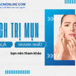 Bật mí cách trị mụn hiệu quả nhanh nhất giúp da mịn đẹp từ chuyên gia