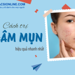 Cách trị thâm mụn bằng nguyên liệu thiên nhiên cực kỳ hiệu quả