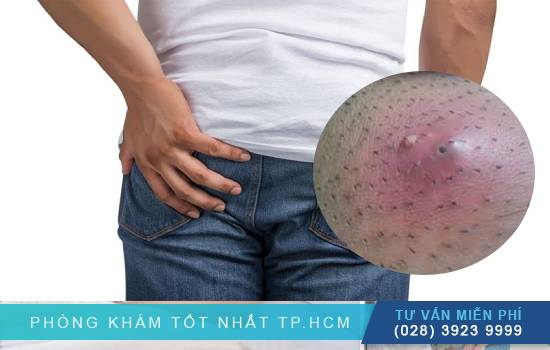 Ảnh 1