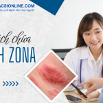 Làm thế nào để áp dụng đúng cách chữa bệnh zona?