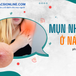 Mụn nhọt ở nách và hướng dẫn chăm sóc chi tiết từ A đến Z