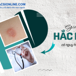 Hắc lào có nguy hiểm không theo đánh giá của chuyên gia da liễu