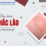 Có cần chữa hắc lào hay để tự khỏi được?