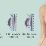 Nâng ngực cho con bú hay bảng giá lệch sâu đáng lưu ý hơn?