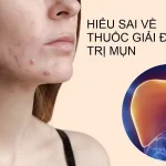 Tránh lấy thuốc giải độc gan để trị mụn