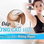Dẫu giá nâng ngực bao nhiêu thẩm mỹ đẹp cạnh tranh sẽ tốt