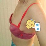 Dứt điểm vóc dáng ngực chảy xệ phải làm thế nào