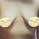 Hiệu quả của việc tập ngực bị xệ thế nào