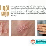 Khám bệnh xã hội ở TPHCM – Top 10 địa chỉ uy tín