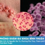 Phòng Khám Đa Khoa Bình Thuận Chia Sẻ: Những Dấu Hiệu Cần Đi Khám Ngay