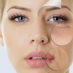 Chia sẻ bí quyết xóa nếp nhăn ở đuôi mắt