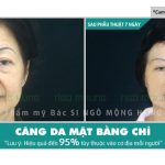 Chia sẻ ăn gì để xóa nếp nhăn