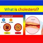 Cholesterol: loại chất này tốt hay xấu cho cơ thể?