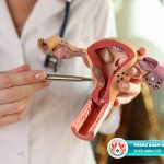 Chữa viêm âm đạo ở TPHCM tại địa chỉ nào uy tín và hiệu quả?