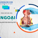 Nhận biết dấu hiệu trĩ ngoại để phòng tránh biến chứng