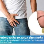 Dương Vật Chảy Dịch Vàng – Nguyên Nhân Và Cách Điều Trị Hiệu Quả