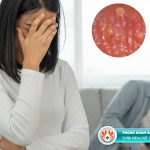 Địa chỉ trị gai sinh dục ở TPHCM uy tín