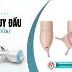 Chi phí cắt bao quy đầu ở TPHCM là bao nhiêu?