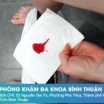 Cách Phân Biệt Máu Kinh Và Máu Sảy Thai – Thông Tin Quan Trọng Cho Chị Em