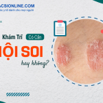 Khám trĩ có cần nội soi không? Khi nào nên thực hiện nội soi?