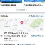 Hỏi đáp: có nên nâng ngực nội soi chảy xệ không