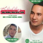 Nhược điểm nâng mũi bọc sụn mà bạn cần nên biết?