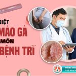 Sùi mào gà ở hậu môn và bệnh trĩ làm sao để phân biệt?