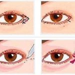 Bật mí cách để cải thiện mắt xếch gò má cao