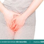 Phụ nữ đi tiểu buốt có cần kiêng quan hệ không?