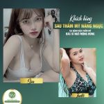 Top những cách nâng ngực to hơn