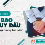 Tổng hợp 10 địa chỉ cắt bao quy đầu an toàn ở Tiền Giang