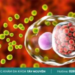 Tìm hiểu Chlamydia gây bệnh gì? Có nguy hiểm không?