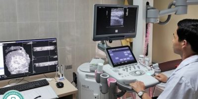 Siêu Âm 2D, 3D Và 4D Khác Nhau Như Thế Nào? Mẹ Bầu Phải Nắm Rõ