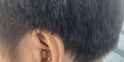 Máy trợ tính thẩm mỹ – máy trợ thính trong tai