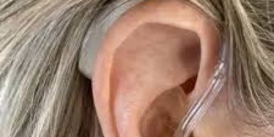 Máy trợ thính Phonak Naida L70-UP – Công nghệ Thụy Sĩ cho thính lực nặng