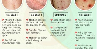 Nhận biết biểu hiện đầu tiên của bệnh giang mai để điều trị sớm